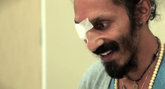 Kevin-Naidoo-Glaucoma-who-did-stem-cell