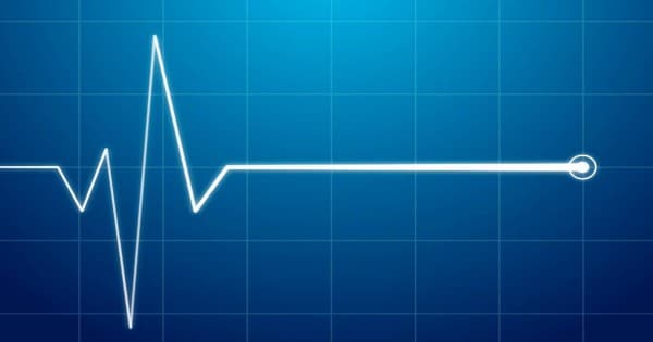 electrocardiogram waves on a digital display