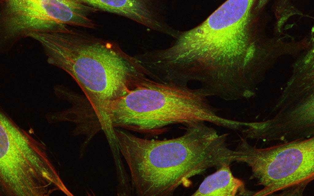 UCMSC Stem Cells